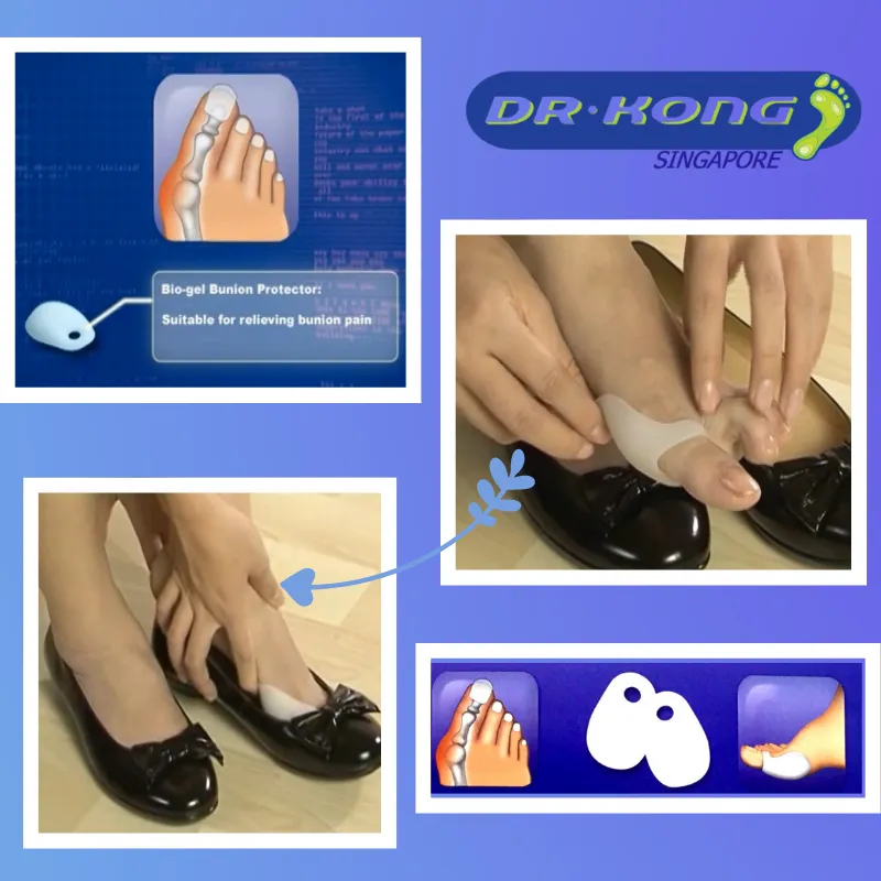 DR.KONG BIO-GEL-BUNION PROTECTOR ACCESSORIES DK-DKA10-F(RP : $16.90)